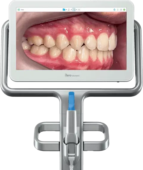 Depois do tratamento Invisalign